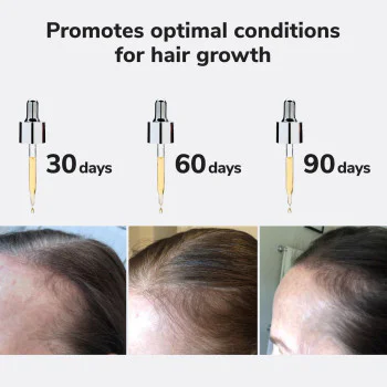 Youth Juice - collagen scalp treatment