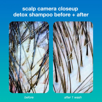 PEPTIDE PREP™ DETOX SHAMPOO – глубоко очищающий шампунь